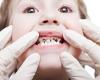حکایت قطره‌ای که دندان کودک را سیاه می‌کند 