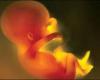 حكم استفاده از جنين سقط شده انسان