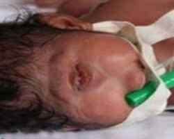 تولد نوزاد عجیب یهودی +عکس