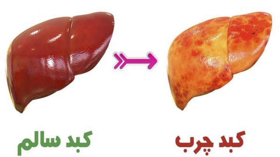 غذاهایی که کبد را پیر می کند