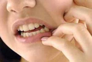 دندانپزشکی رفتن در رمضان روزه را باطل می کند؟ 