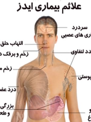 ايدز اولين بار در اين كشور متولد شد