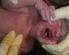 تولد نوزاد با دو دندان در حين تولد +عكس