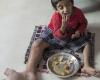 بیماری عجیب پسر چهار ساله هندی (تصاویر)
