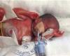 کوچک‌ترین نوزاد متولد شده در دنیا +عکس