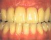 6 راز برای داشتن دندان‌های سفیدتر و درخشانتر