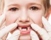 سن دندانی کودکان چقدر است.؟