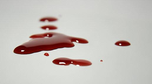 آیا خونریزی لثه در رمضان روزه را باطل می کند؟